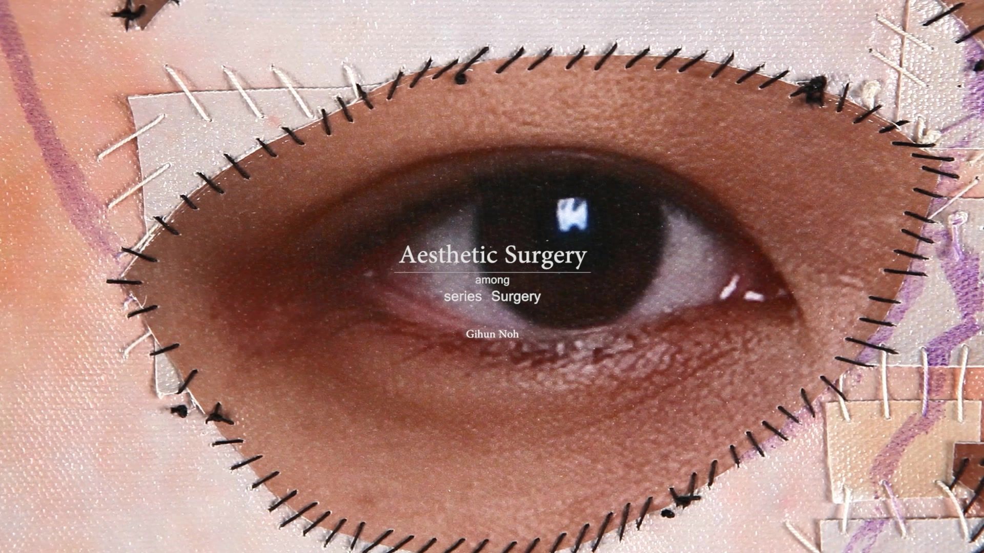 Aesthetic Surgery series Aesthetic Surgery, DV with Sound, 15min 31sec, 2012